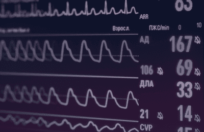 How to measure customer health